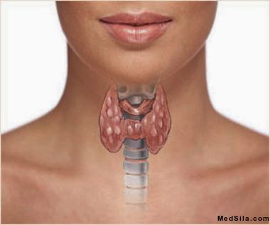no alt var
